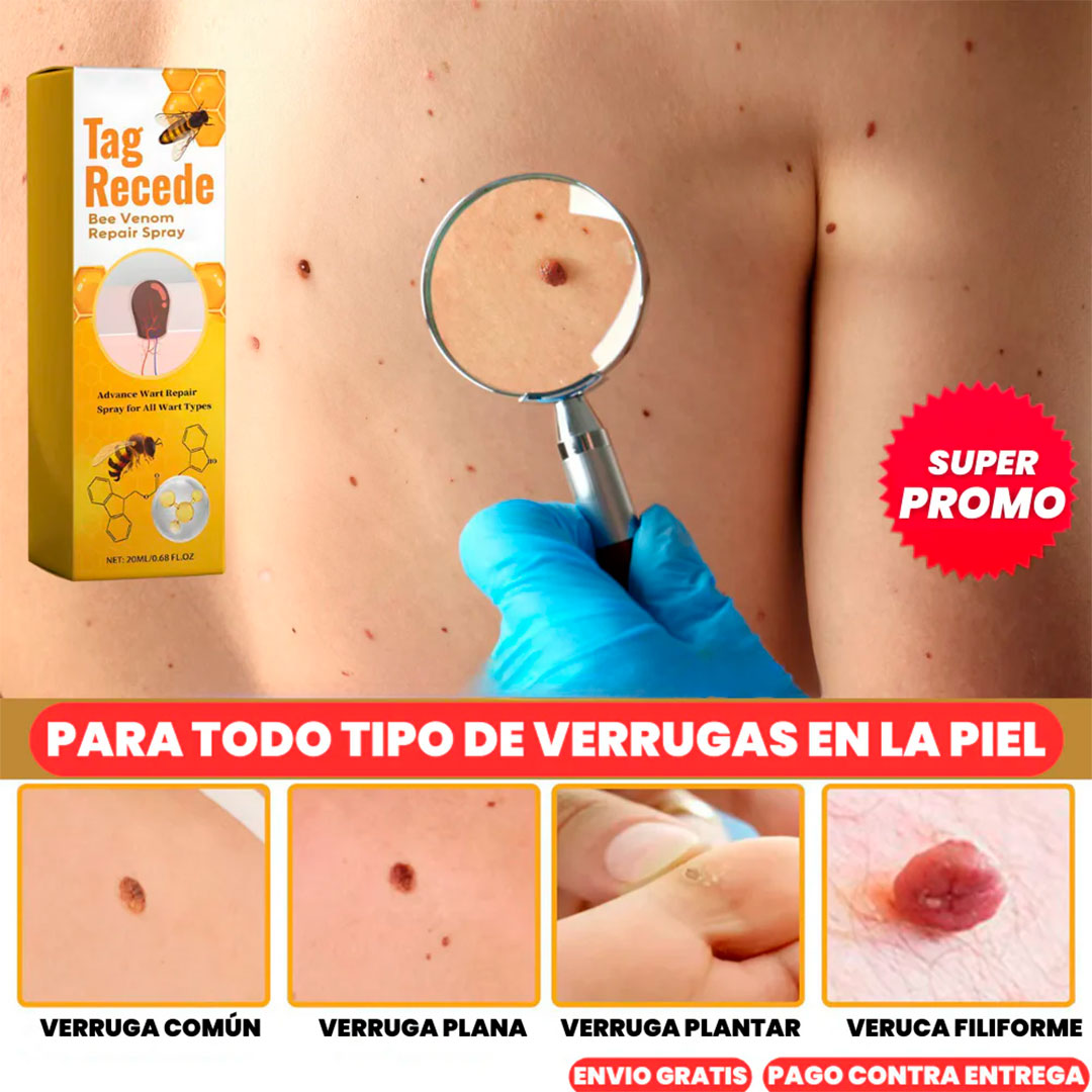 DermaClean PRO – Tratamiento Natural para Verrugas y Lunares🐝🧑⚕️
