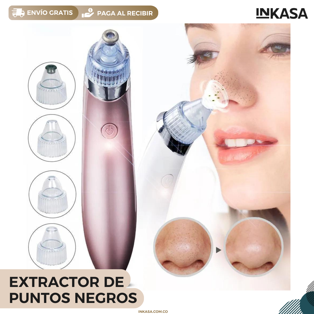 Extractor de puntos negros