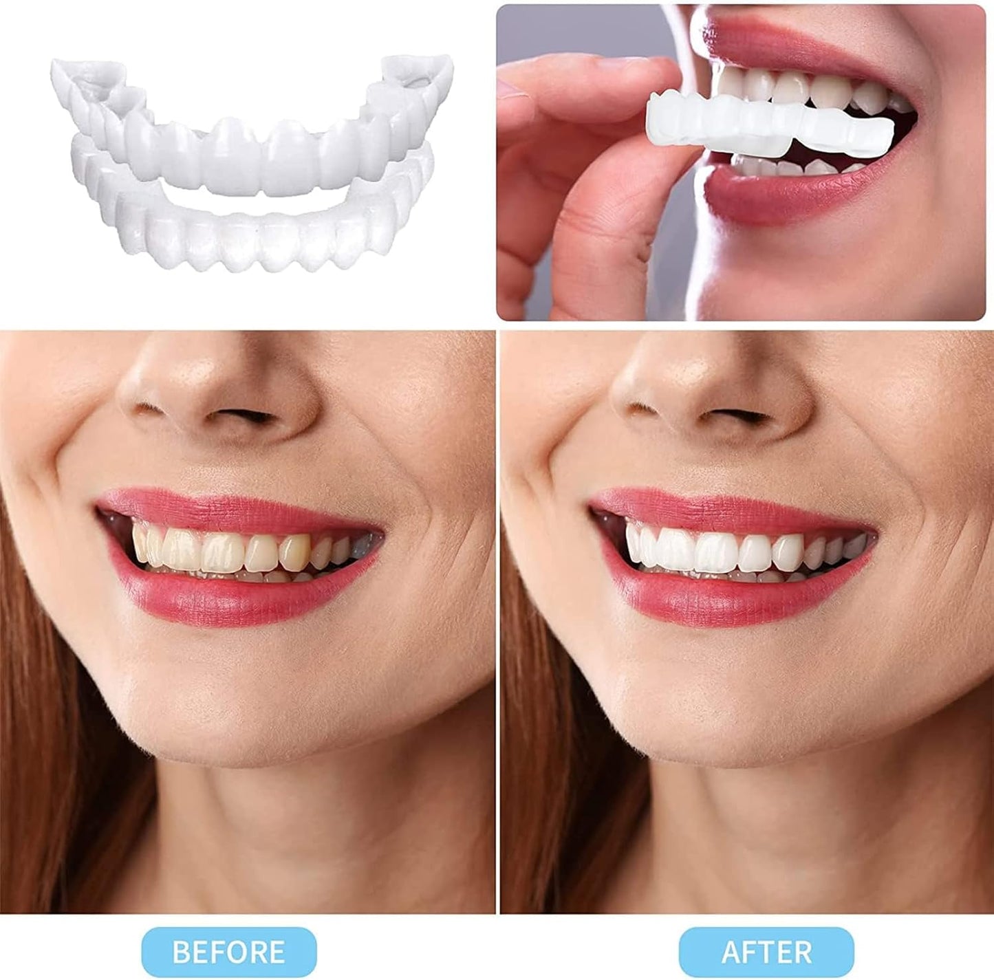 🦷🤩SmileFix PRO – Carillas Dentales Instantáneas Superior e Inferior Ajustables😁