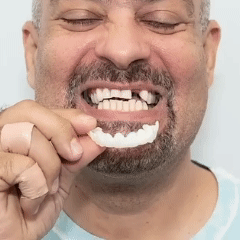 🦷🤩SmileFix PRO – Carillas Dentales Instantáneas Superior e Inferior Ajustables😁