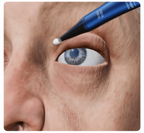 Kit de renovador de ojos - reafirma, despigmenta y reduce la inflamación✨
