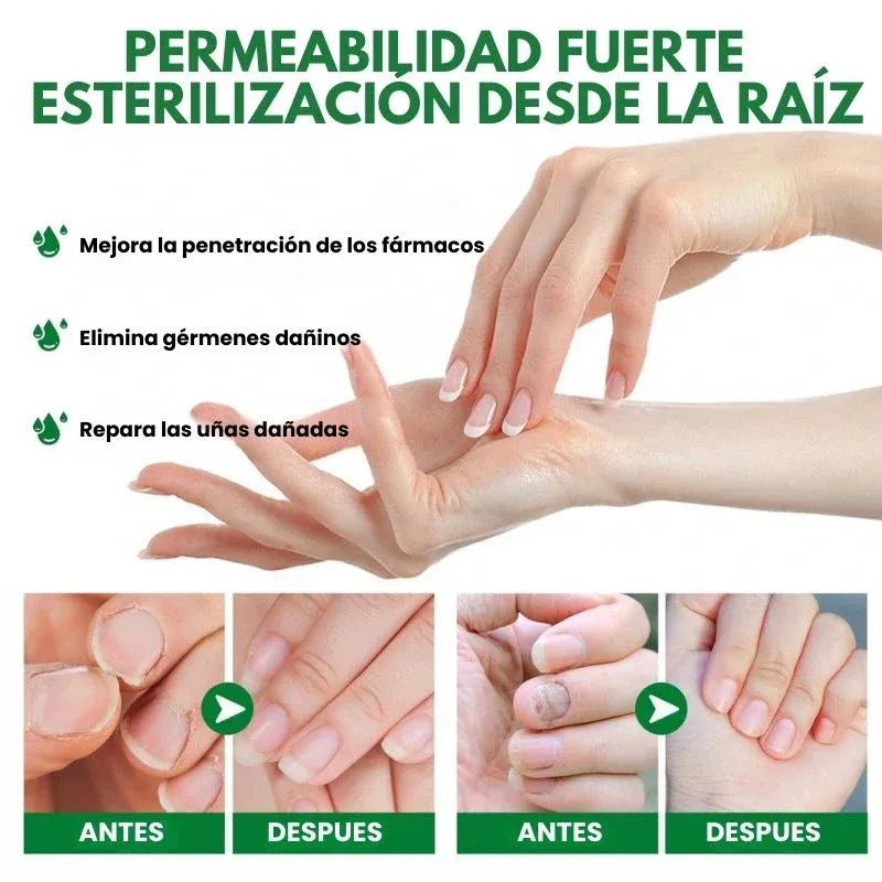 RETO 7 DÍAS LIBRE DE HONGOS EN UÑAS X2® Protege y elimina el hongo de tus uñas🦶🏻💅🏻