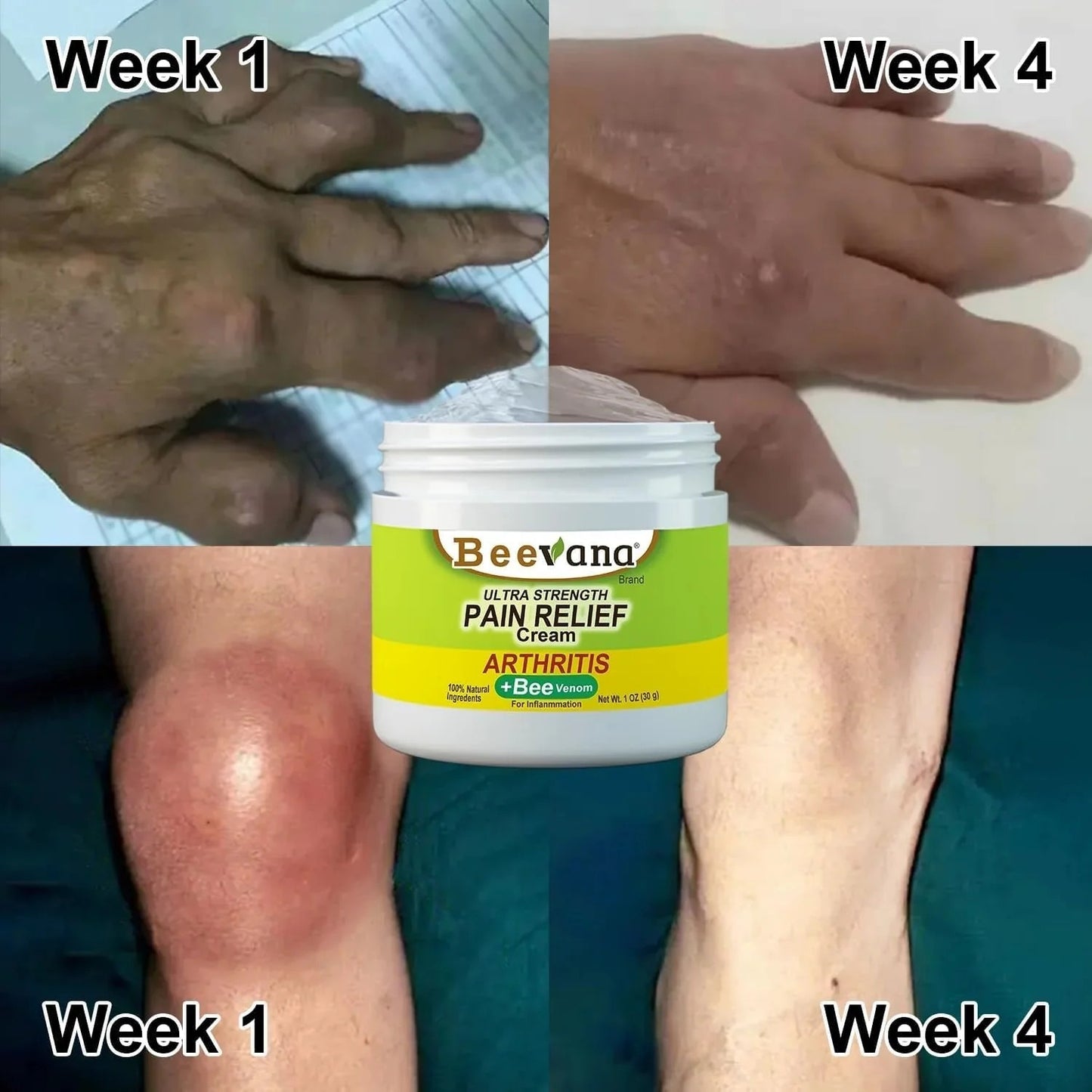 Crema con VENENO DE ABEJA🐝🍃 Restaurador de articulaciones y eliminador de dolor