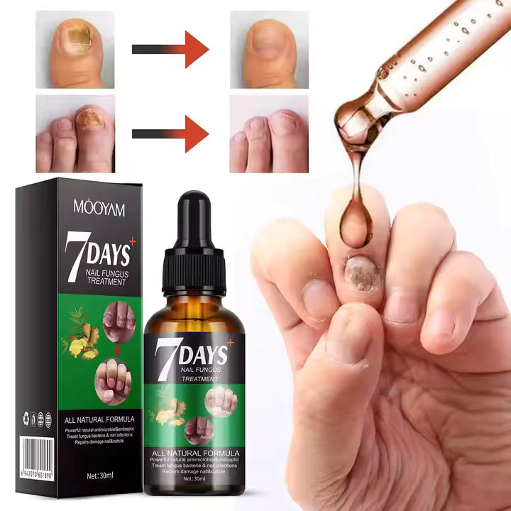 RETO 7 DÍAS LIBRE DE HONGOS EN UÑAS X2® Protege y elimina el hongo de tus uñas🦶🏻💅🏻