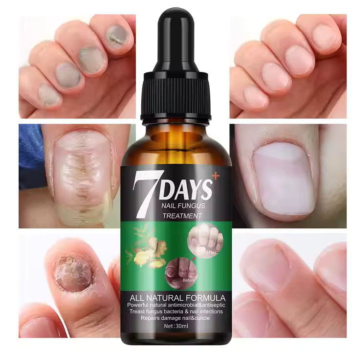 RETO 7 DÍAS LIBRE DE HONGOS EN UÑAS X2® Protege y elimina el hongo de tus uñas🦶🏻💅🏻