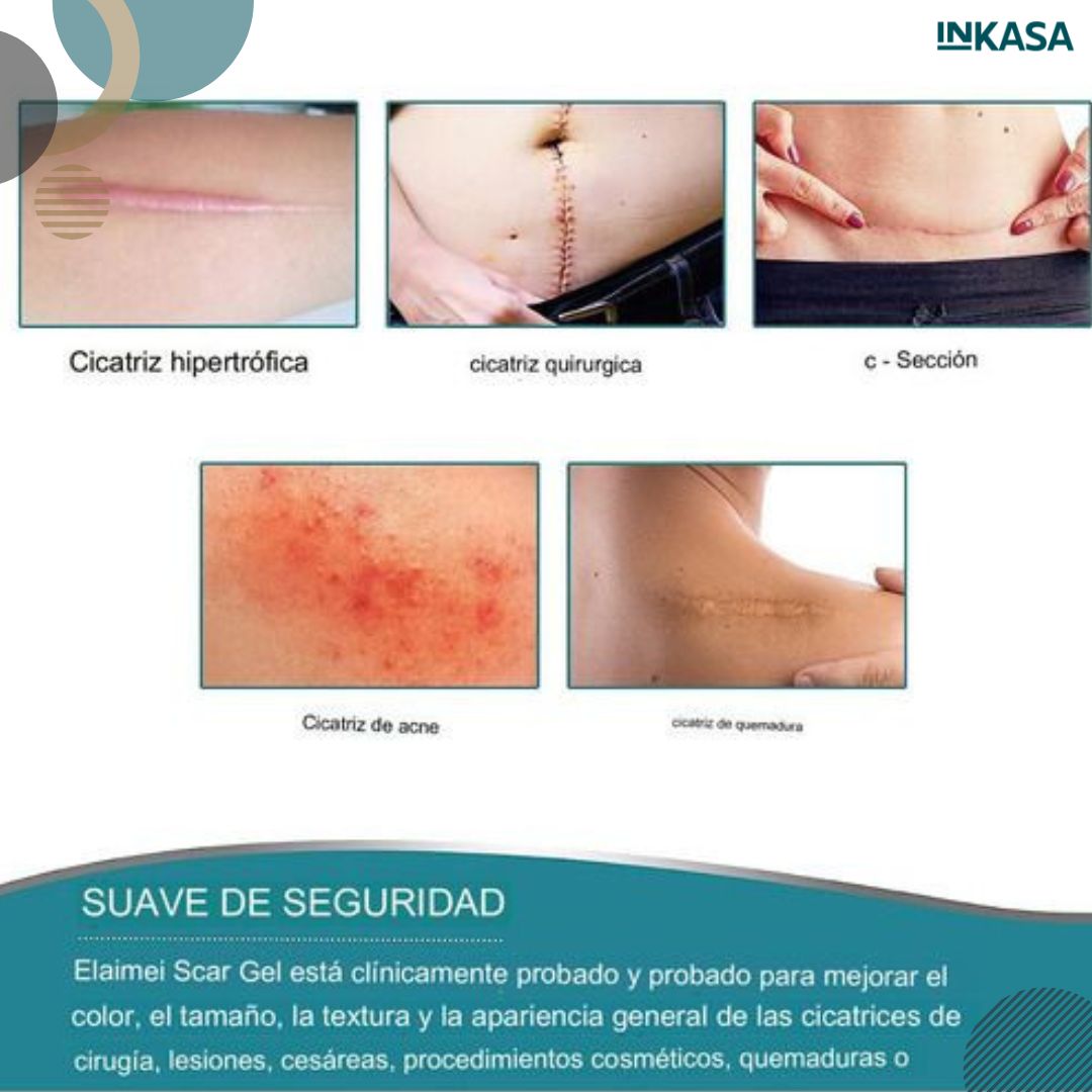 Parche de Silicona para eliminar citarices