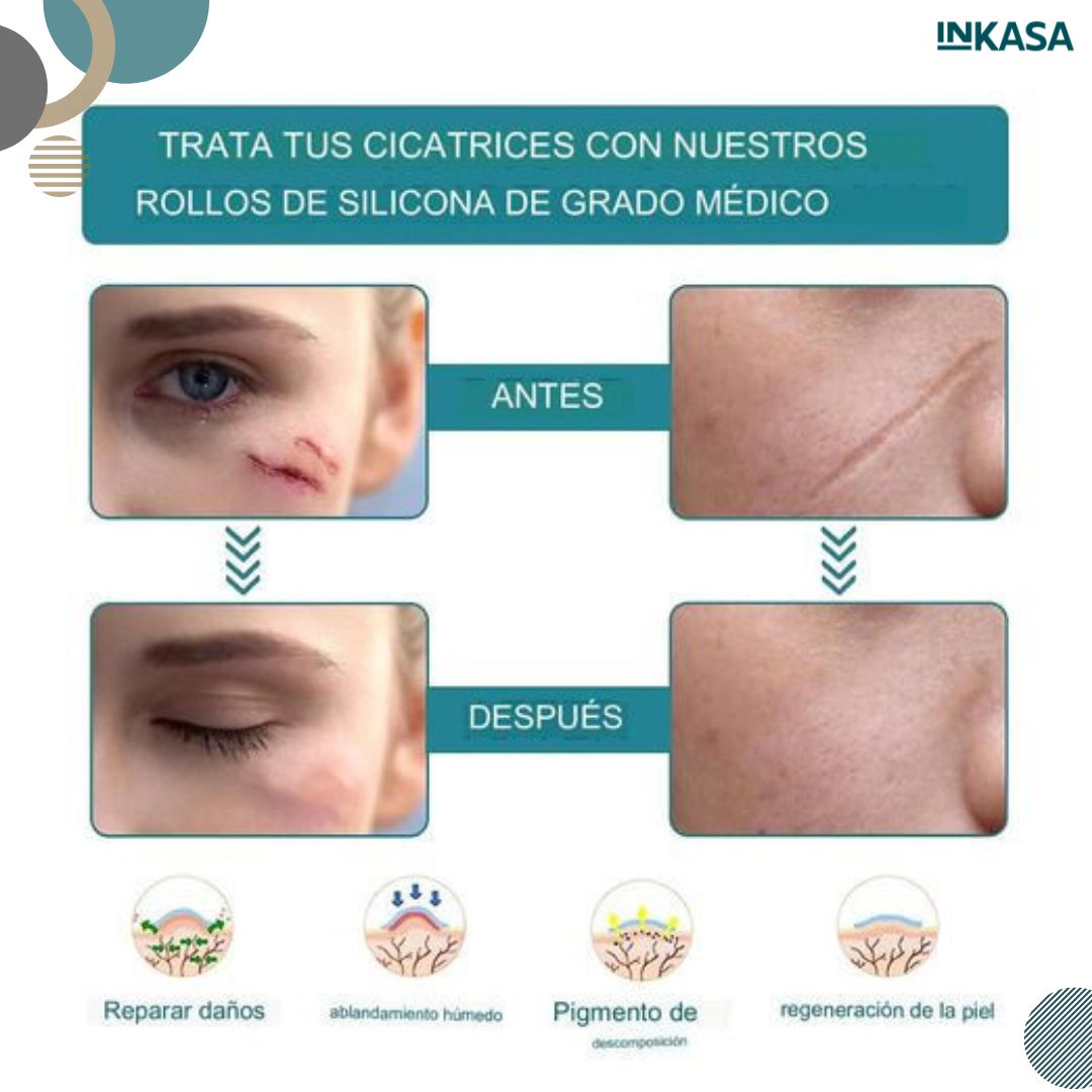 Parche de Silicona para eliminar citarices