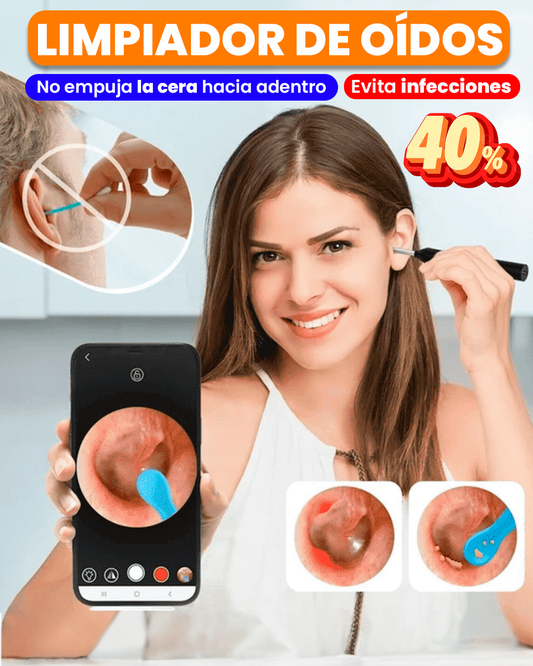 LIMPIADOR DE OIDOS CON CÁMARA✅