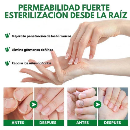 RETO 7 DÍAS LIBRE DE HONGOS EN UÑAS X2® Protege y elimina el hongo de tus uñas🦶🏻💅🏻