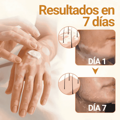VitiClear Pro Crema de veneno de abeja ANTI-MANCHAS 🐝😎
